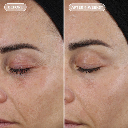 AGELESS+ Retinol - Repair Crème 0.3% Retinol Complex