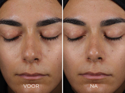 DAILY PREVENTION+ Sheer Matte Moisturizer SPF30 (77ml)